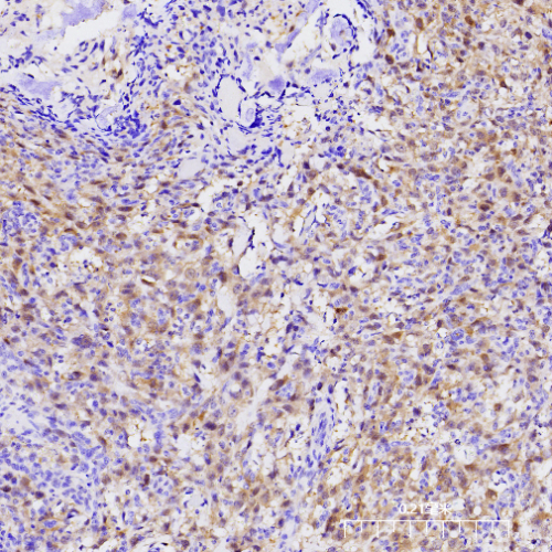 CDK4 Antibody Reagent for Immunohistochemistry